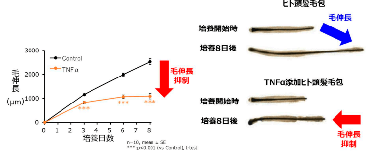 図２ ヒト頭髪毛包の毛伸長に対する炎症（TNFα※2）の影響