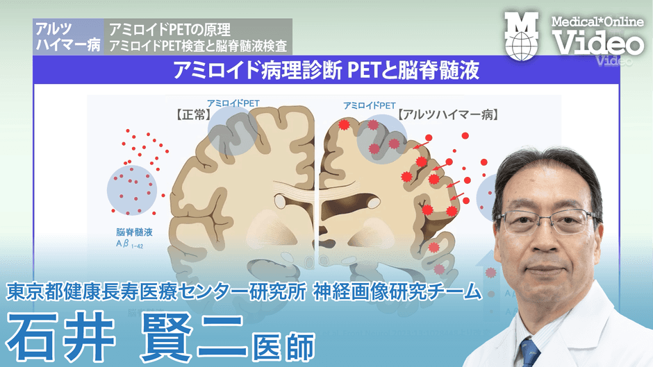 アルツハイマー病 アミロイドPETの原理 ガイドライン概要