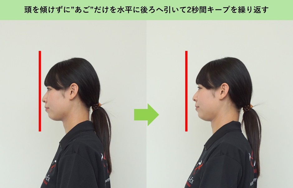 水平あご引き