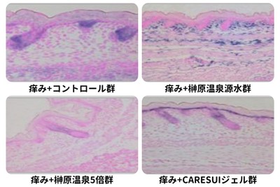 図1：痒みを発生させた皮膚のH&E染色の画像による分析