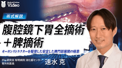 腹腔鏡下胃全摘術＋脾摘術