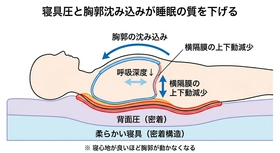寝具圧と胸郭沈み込みが睡眠の質を下げる──睡眠中の呼吸を静かに奪う"密着構造"の盲点　シリーズ第4回