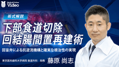 下部食道切除・回結腸間置再建術