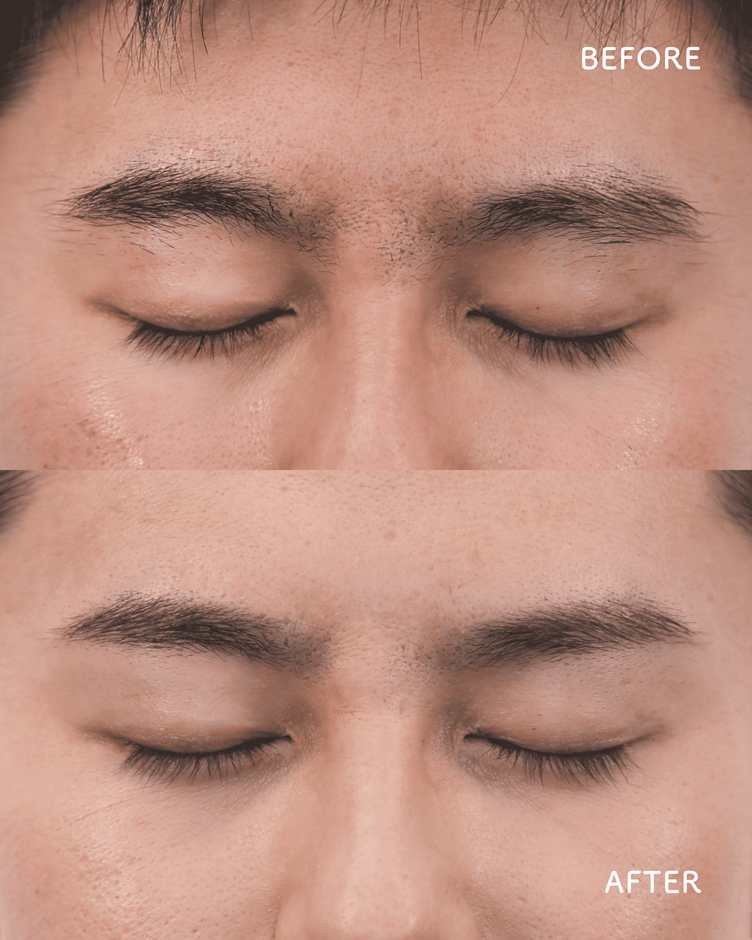 男性ビフォーアフター
