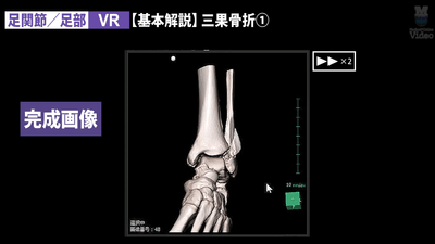 足関節
