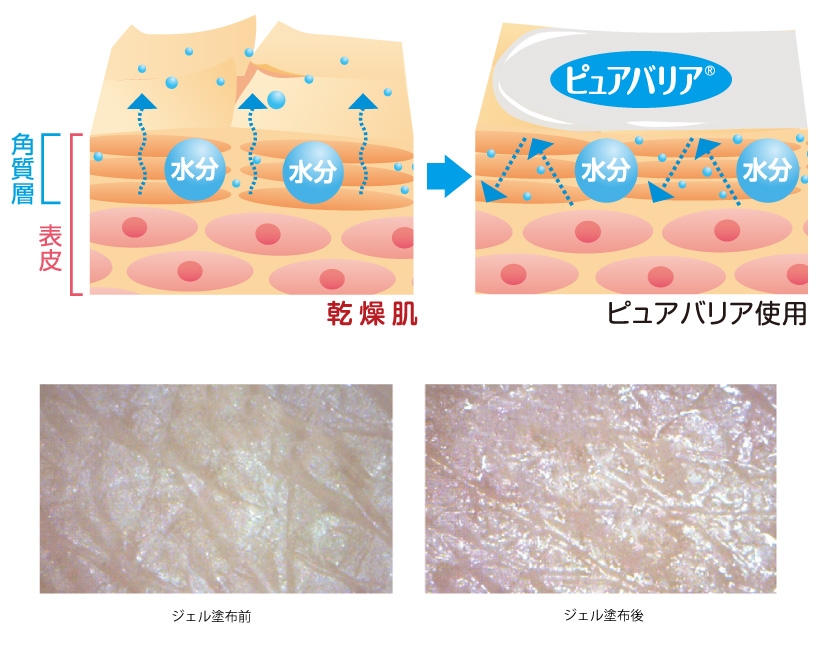 テーピング用ピュアバリアで保湿