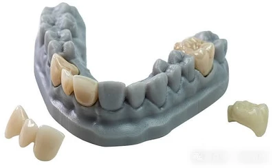 世界3Dプリント義歯市場調査2026：2032年2286百万米ドル規模を展望