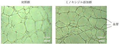 図２．ミノキシジル添加による血管網形成の促進