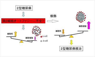 膵β細胞のオートファジー不全と2型糖尿病