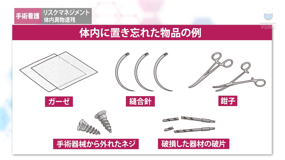 体内遺物残留