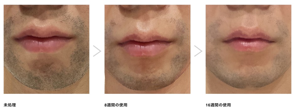 定期的なフェイスケア