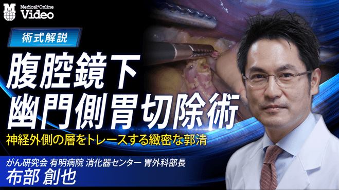 腹腔鏡下幽門側胃切除術